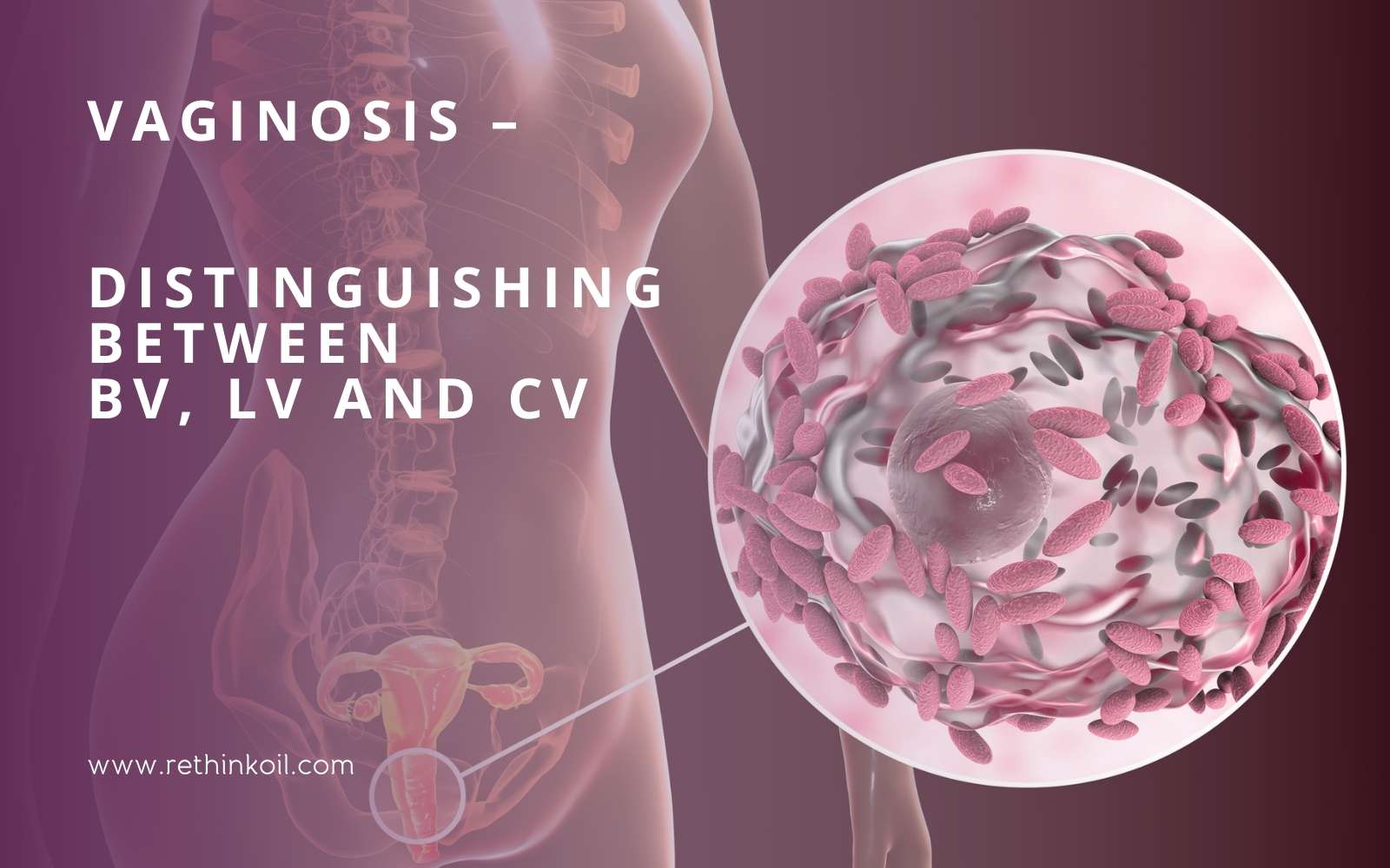 vaginosis-distinguishing-between-bv-lv-and-cv-rethinkoil